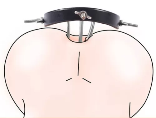 Xtreme Spreader, 14 cm - Max. szélesség: 11 cm